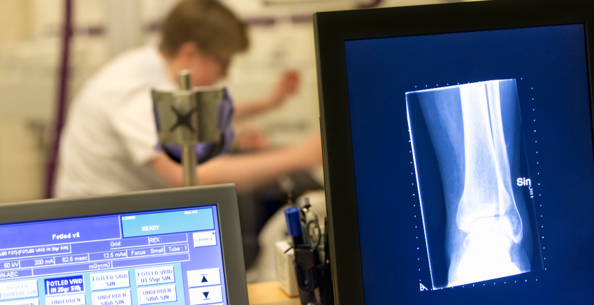 I förgrunden två bildskärmar i blå toner. Den högra visar en röntgenbild av en fotled. I bakgrunden skymtar en röntgensjuksköterska något böjd över en brits där man anar en patient.